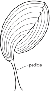 pedicle